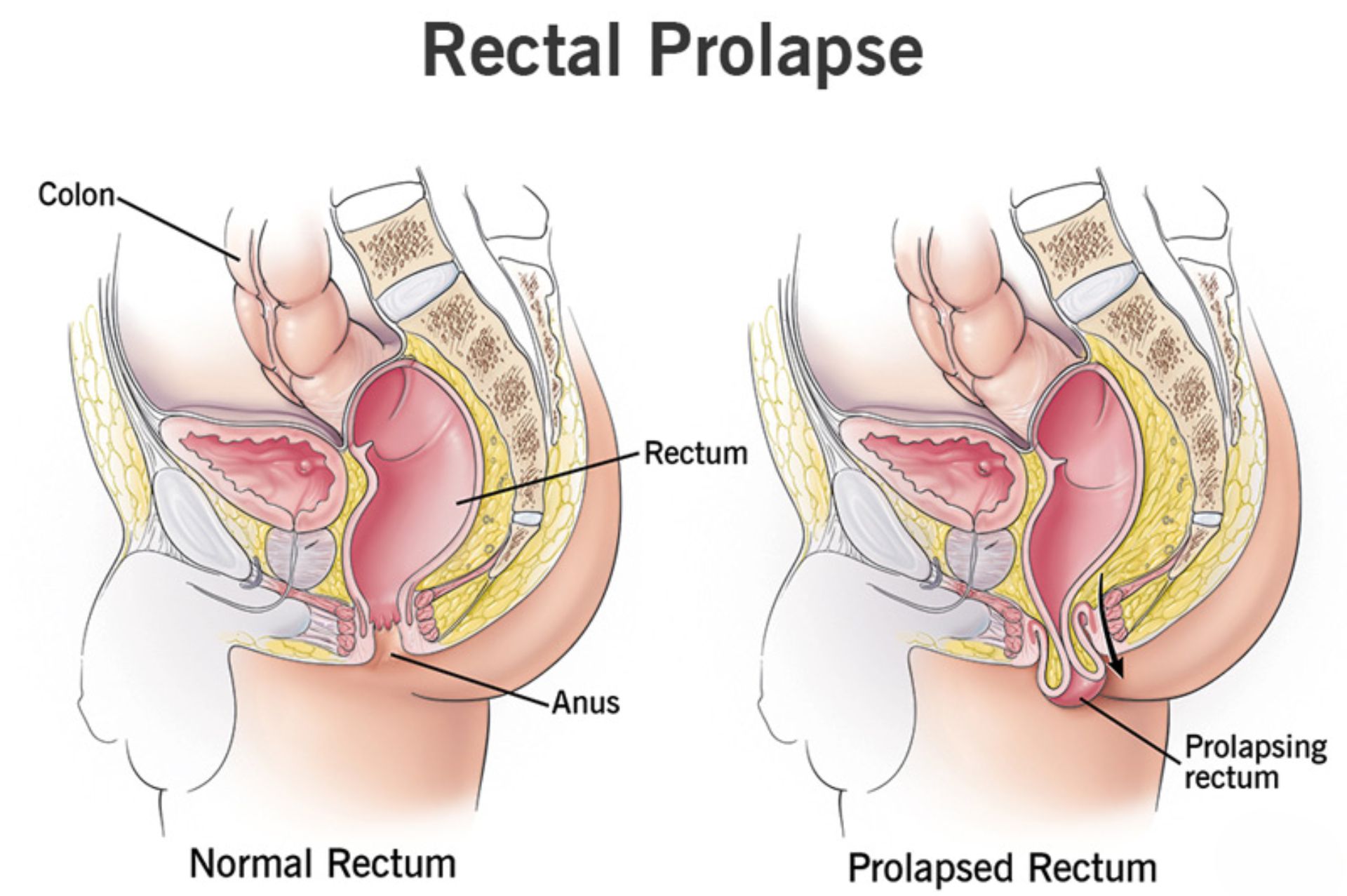 Guruh porno video Lesbian anusni erkalash surati